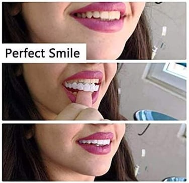 Instant Snap-On Veneers 2 Pairs Cosmetic Teeth Covers for Upper & Lower Teeth, Temporary Smile Enhancer Clip-On Dentures for Men & Women